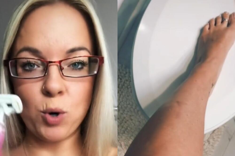 ZBOG OVE GREŠKE VAM URASTAJU DLAKE NA NOGAMA: Brijete se potpuno POGREŠNO i pravite KATASTROFU (VIDEO)