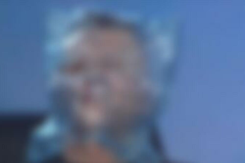 ĐORĐA DAVIDA GUŠE U KESI: Fotke njegove glave će vam izazvati NOĆNU MORU - JEZIVO!