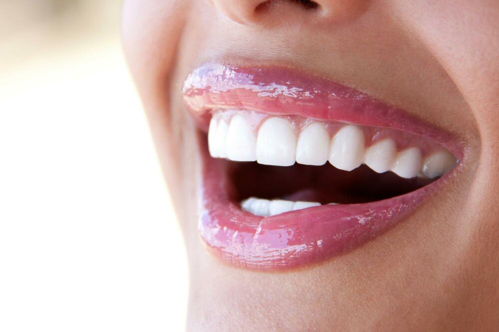 VELIKA AKCIJA POVODOM DANA ŽENA: Ne propustite ovu priliku da učinite vaše zube blistavo belim uz Ola Smile set!