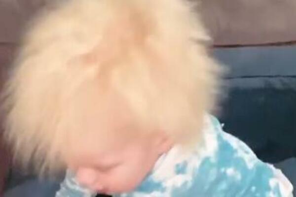 LEKARI OTKRILI REDAK SINDROM KOD 1 MALIŠANA: Ljudi GLEDAJU u NJEGOVU KOSU i NE VERUJU, majka sve OBJASNILA (FOTO)