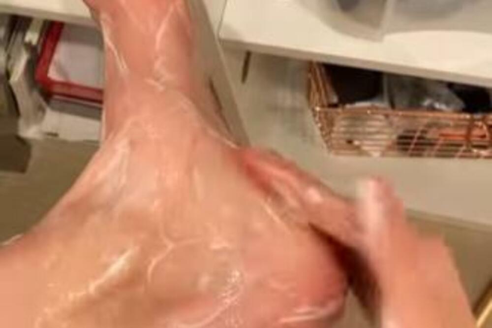 OVA JEFTINA NAMIRNICA EFIKANSO REŠAVA PROBLEM ISPUCALIH PETA: Sigurno je imate u kući