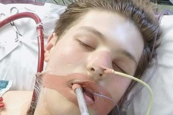 OD 16. GODINE JE BIO PUŠAČ: Zbog "ZDRAVIJE VARIJANTE" OTKAZAO MU JE SVAKI ORGAN, A PLUĆA SU MU IZGLEDALA OVAKO