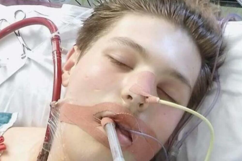 OD 16. GODINE JE BIO PUŠAČ: Zbog "ZDRAVIJE VARIJANTE" OTKAZAO MU JE SVAKI ORGAN, A PLUĆA SU MU IZGLEDALA OVAKO