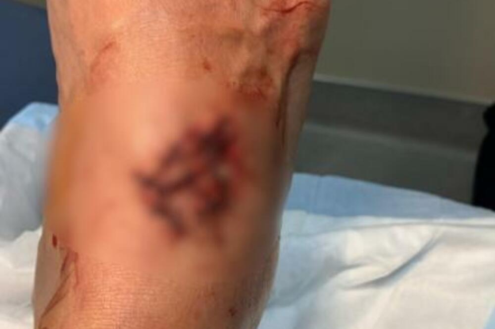 Mogao da ostane bez stopala! UMALO MASAKR MOTORNOM TESTEROM! Dobro je prošao! (FOTO)