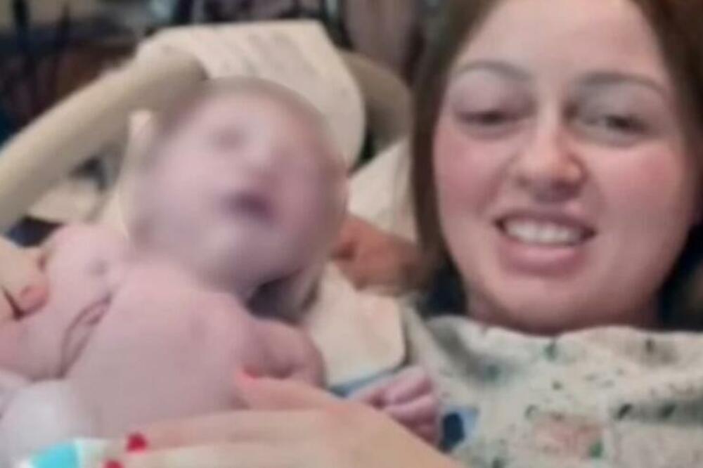 BIZARNU SCENA NA POROĐAJU GLEDAO CEO SVET: Kad joj je ISKOČILO, I LEKARI KRENULI DA SE KRSTE (FOTO, VIDEO)