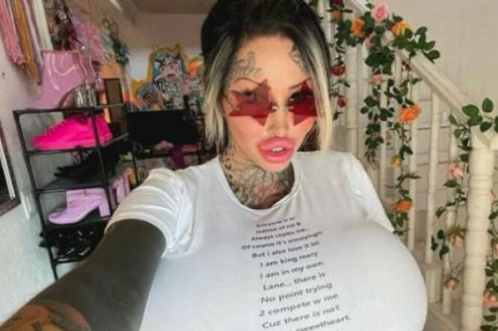 OPERISALA JE VAGINU, PA UMALO UMRLA NA OPERACIONOM STOLU: Okačila i FOTKE, SVEDOČITE SVOJIM OČIMA (FOTO) (VIDEO)