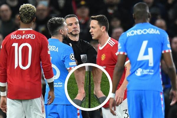 "ĐAVOLI" MU PUSTILI KRV! Ma da li je OVO MOGUĆE? Žive rane nakon meča na Old Trafordu! (FOTO)