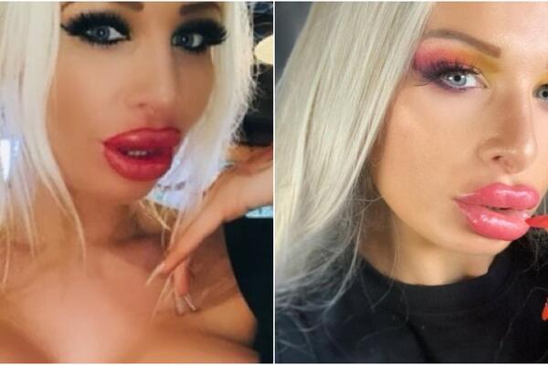 POZNATOJ PLAVUŠI EKSPLODIRAO SILIKON, STRAVIČNO: PAKAO, bila je NA IVICI SMRTI! (FOTO)