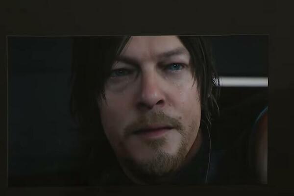 SVET POTREŠEN! POZNATI GLUMAC DOŽIVEO NESREĆU NA SNIMANJU: Posledice na mozgu, ŠOK!