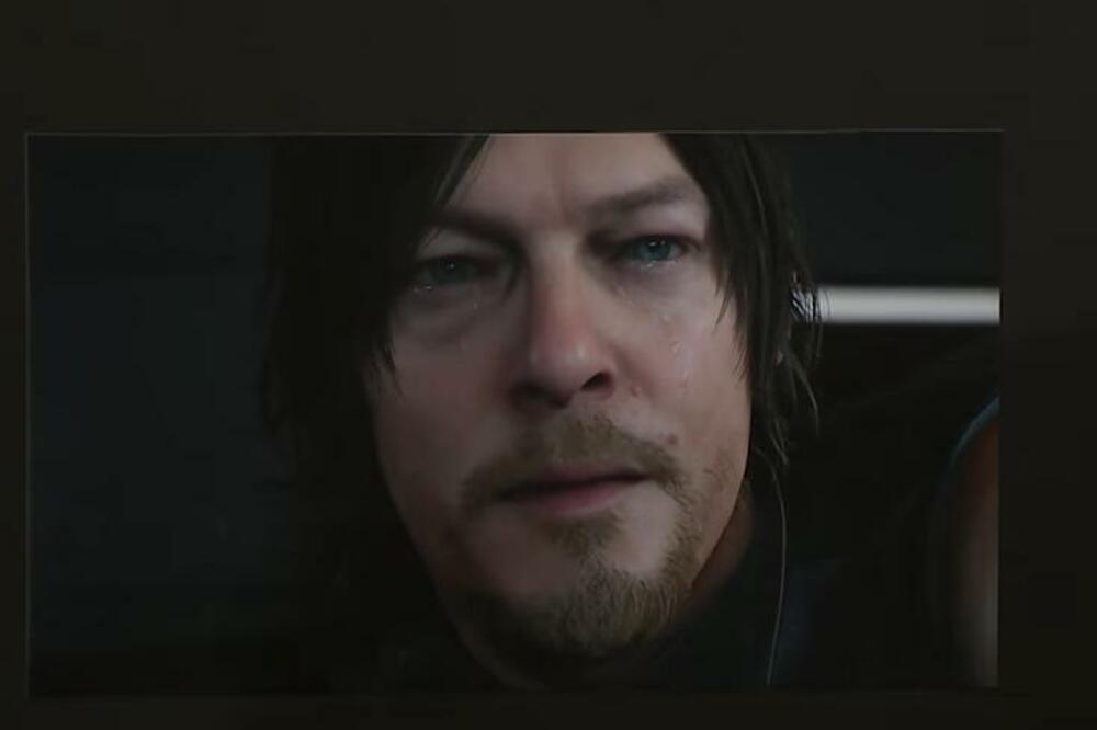 SVET POTREŠEN! POZNATI GLUMAC DOŽIVEO NESREĆU NA SNIMANJU: Posledice na mozgu, ŠOK!