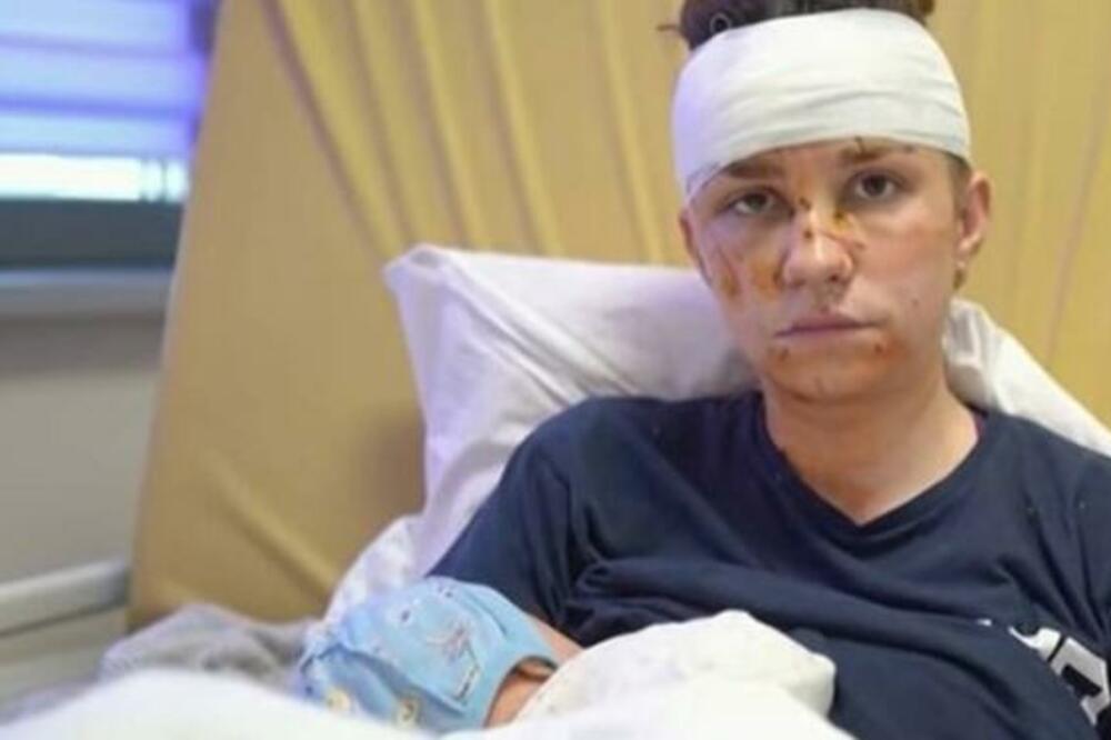 OLGA (27) TEŠKO RANJENA DOK JE ŠTITILA SVOJU BEBU OD GRANATIRANJA! Ukrajinka o ŠOKU koji je doživela u Kijevu