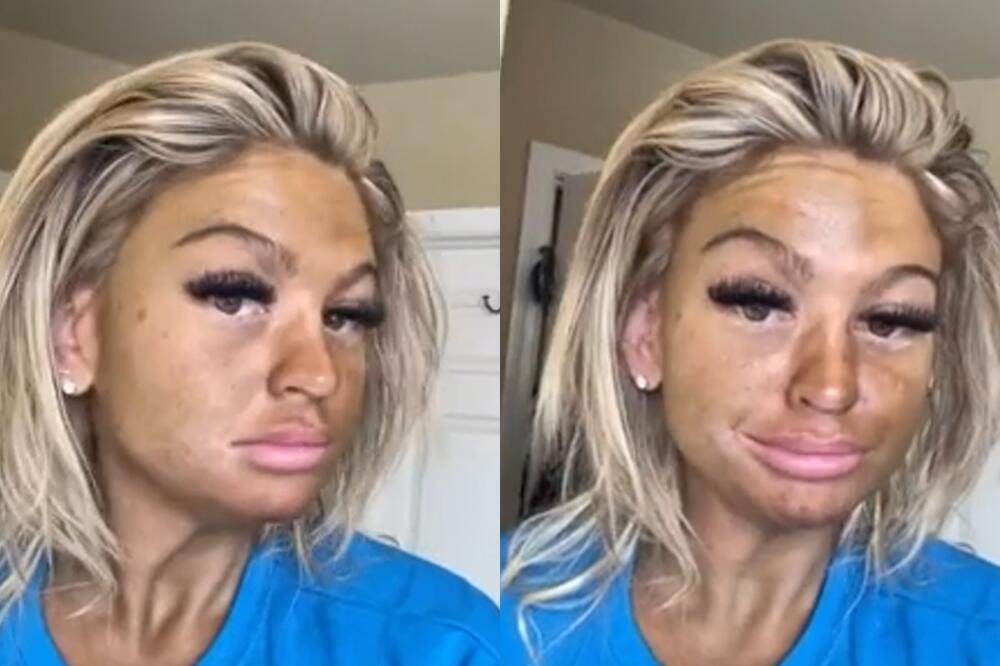 OTIŠLA U SOLARIJUM KAKO BI PRIMILA BOJU: Ono što je DOBILA UMESTO TOGA ZGROZILO JE SVE (FOTO)