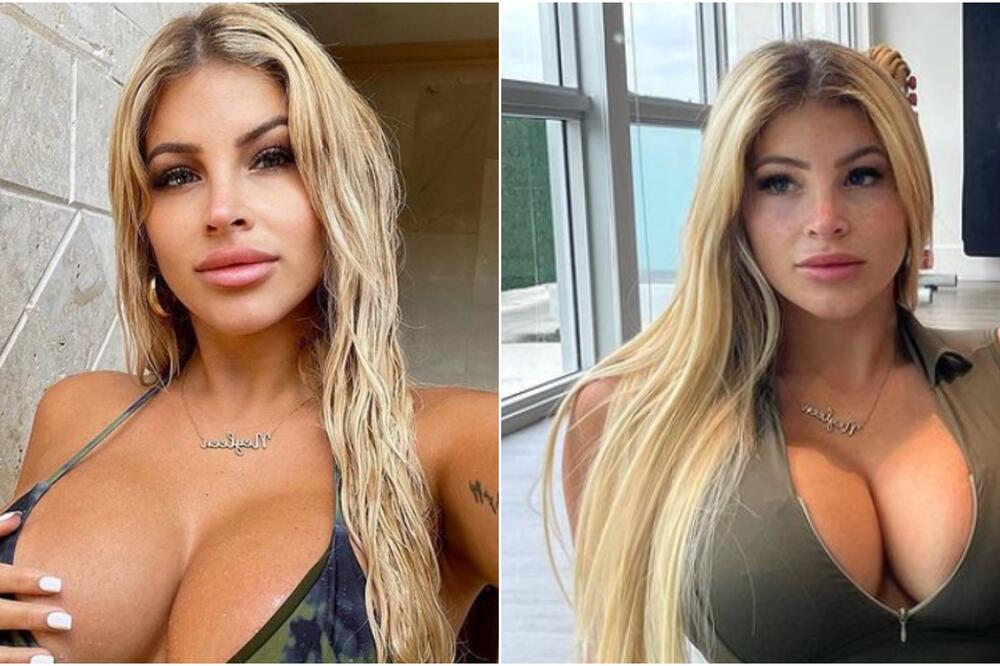 ONA IMA NAJVEĆE GRUDI I ZBOG NJIH JE UPALA U ŽIVOTNI HOROR, ZDRAVLJE JOJ JE U PAKLU, UŽAS ŠTA JOJ SE DESILO!