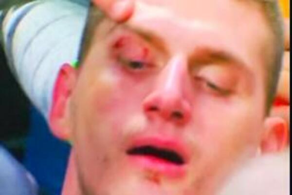 IZUDARAN JOKIĆ! Krvav i modar! Melon pomenuo Nikolinu braću! (FOTO/VIDEO)