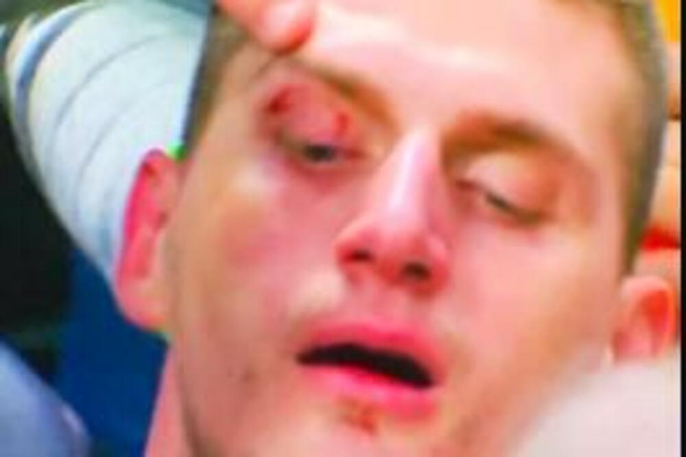 IZUDARAN JOKIĆ! Krvav i modar! Melon pomenuo Nikolinu braću! (FOTO/VIDEO)