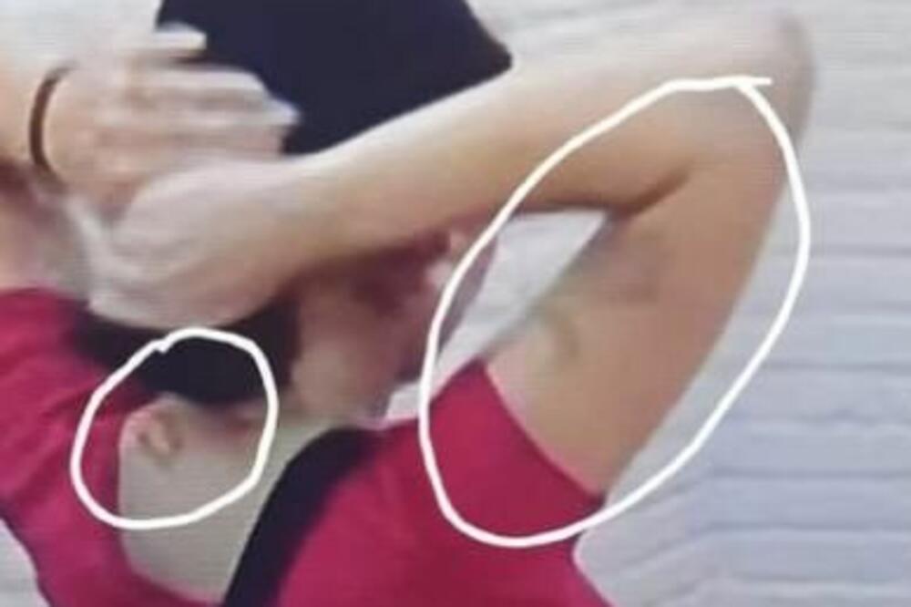 UŽAS! ZADRUGARKA SAMA SEBI PRAVI MODRICE: Kamera krišom snimila JEZIVU SCENU! (VIDEO)