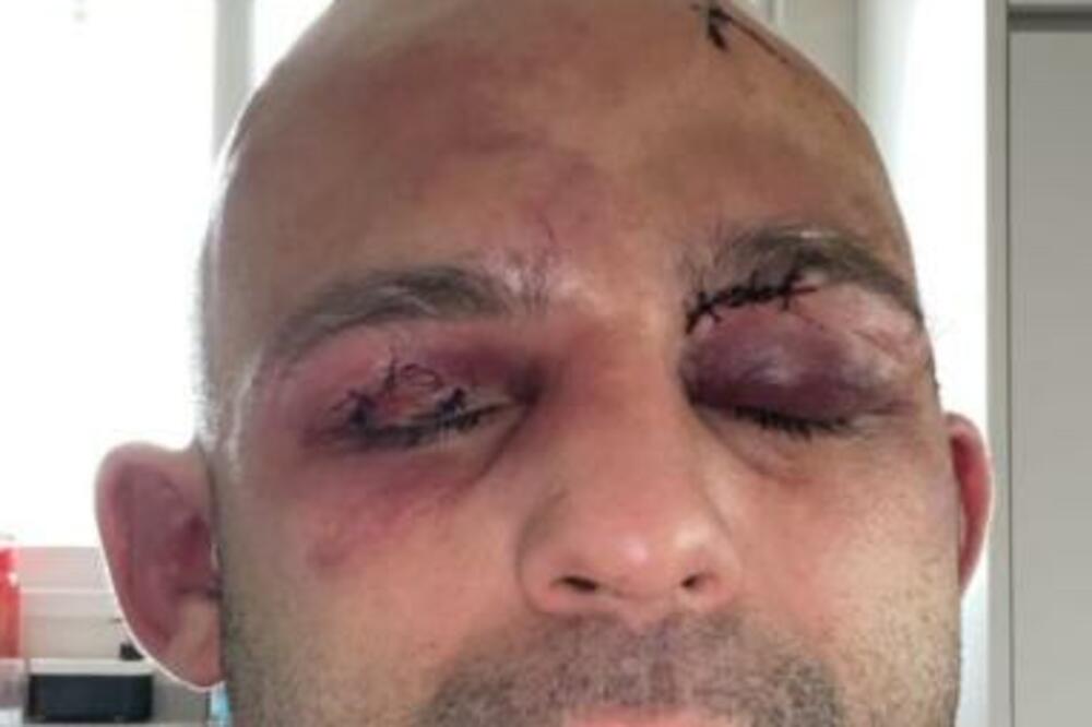 JEZIV PRIZOR! Krv se slivala! UDARAO GA KAO MALJEM! Promenio mu lični opis! (VIDEO)