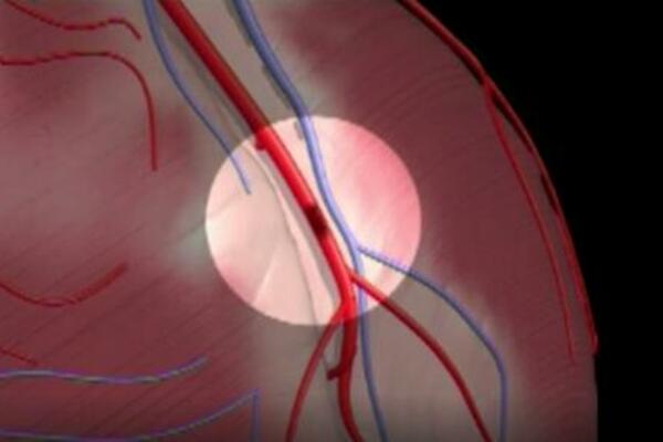 ŠOKANTNO OTKRIĆE LEKARA! Evo kako da otkrijete KARDIOVASKULARNE bolesti, niko nije verovao da je MOGUĆE!