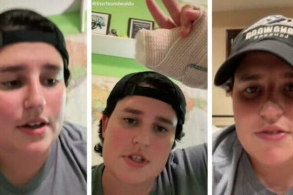 MARIJI JE GODINAMA OVA STVAR RASLA NA NOKTU, NIJE NI ZNALA ŠTA JE: A onda su joj morali ukloniti DEO KOSTI (VIDEO)