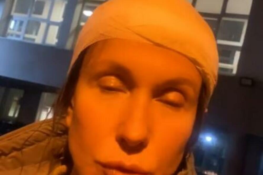 CELA GLAVA U ZAVOJIMA! Oglasila se Snežana Dakić posle napada, evo zbog čeka je pogođena kamenom! (VIDEO)