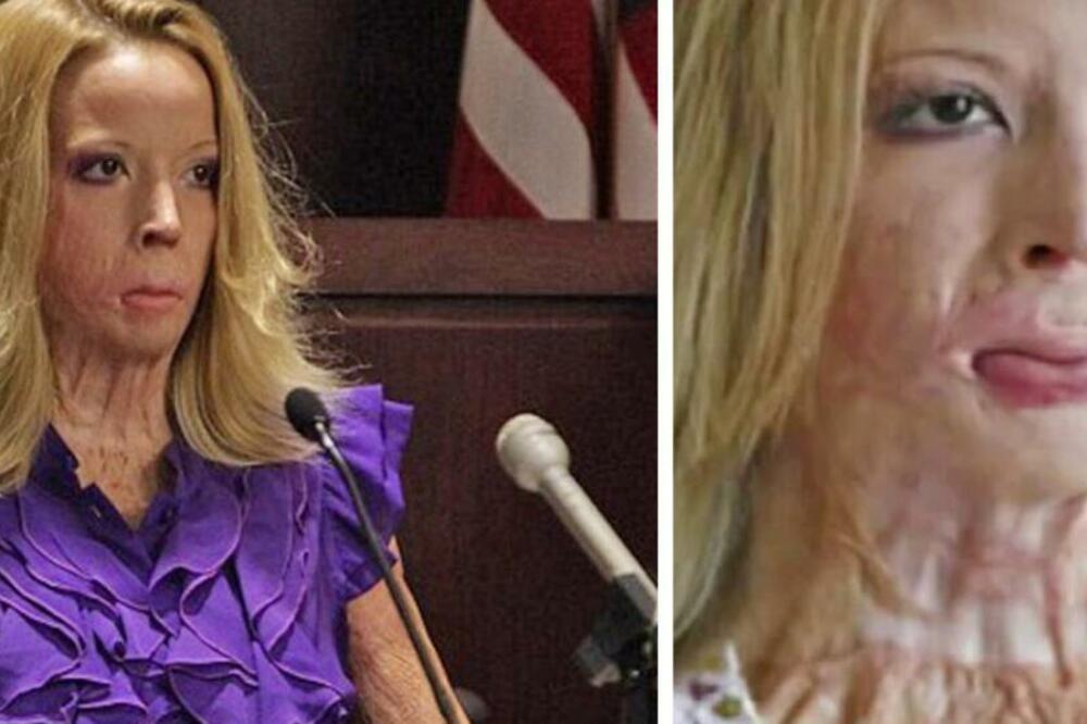 MUŽ JE PRETUKAO I ZAPALIO, NIJE LIČILA NA LJUDSKO BIĆE: 7 godina kasnije OVIM je šokirala čitav svet (VIDEO)