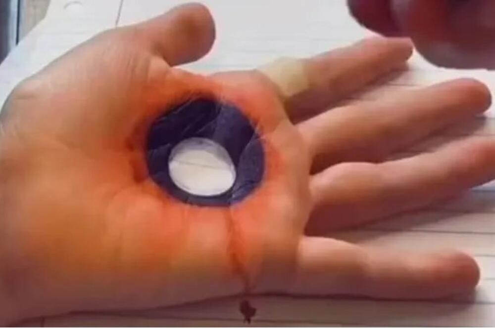 LJUDI NE MOGU DA VERUJU SVOJM OČIMA: Žena sa "RUPOM" u ruci ZALUDELA internet, kroz ŠAKU gurnula i PRST! (VIDEO)