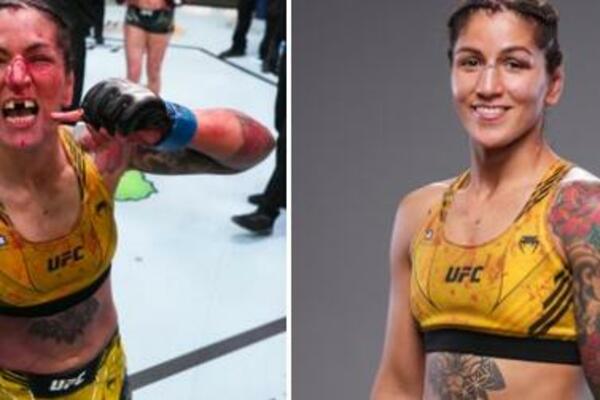 PROMENJEN JOJ LIČNI OPIS! Izgubila prednje zube, nos smrskan! Vredili ti to novca koji je zaradila? (FOTO/VIDEO)