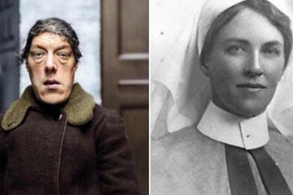 OVA LEPOTICA POSTALA JE NAJRUŽNIJA ŽENA NA SVETU: Zbog ove užane BOLESTI, više nije LJUDSKO BIĆE (FOTO)