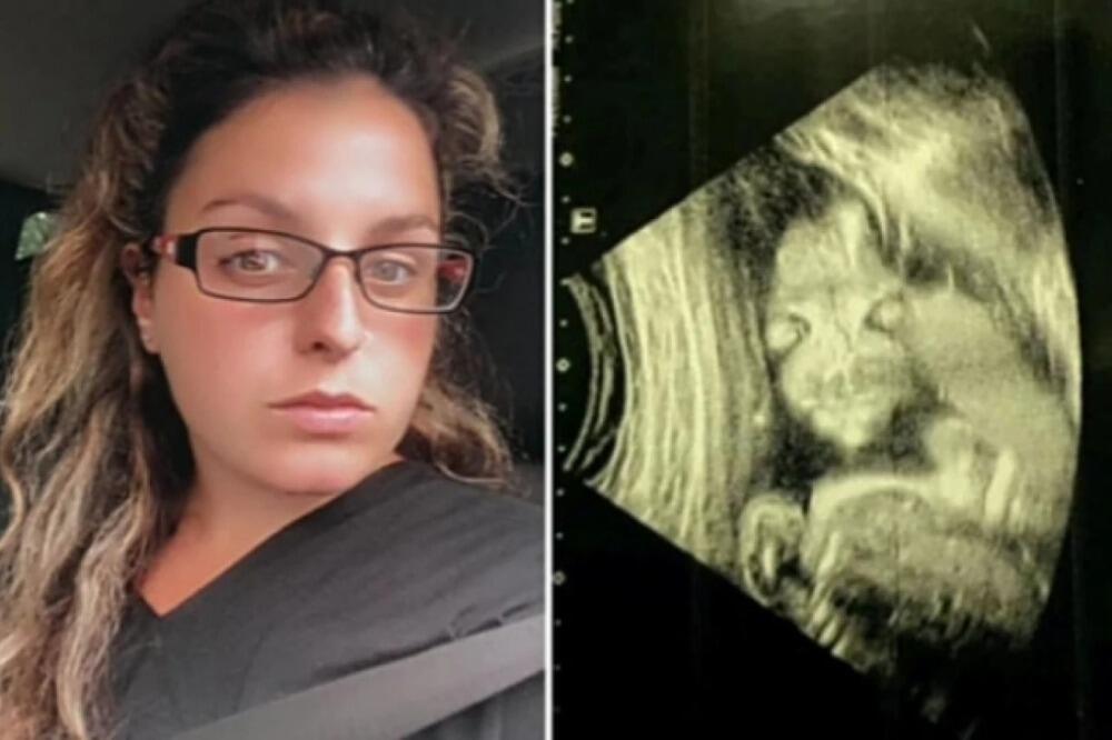 VIDELA JE SNIMAK BEBE U STOMAKU I ODBILA DA SE PORODI! Nije ličilo na čoveka (FOTO,VIDEO)