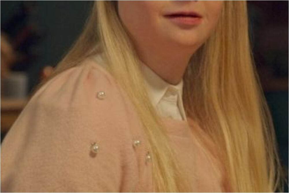 OVO JE PRVA GLUMICA SA DAUNOVIM SINDROMOM! Ostaviće vas bez teksta (FOTO, VIDEO)