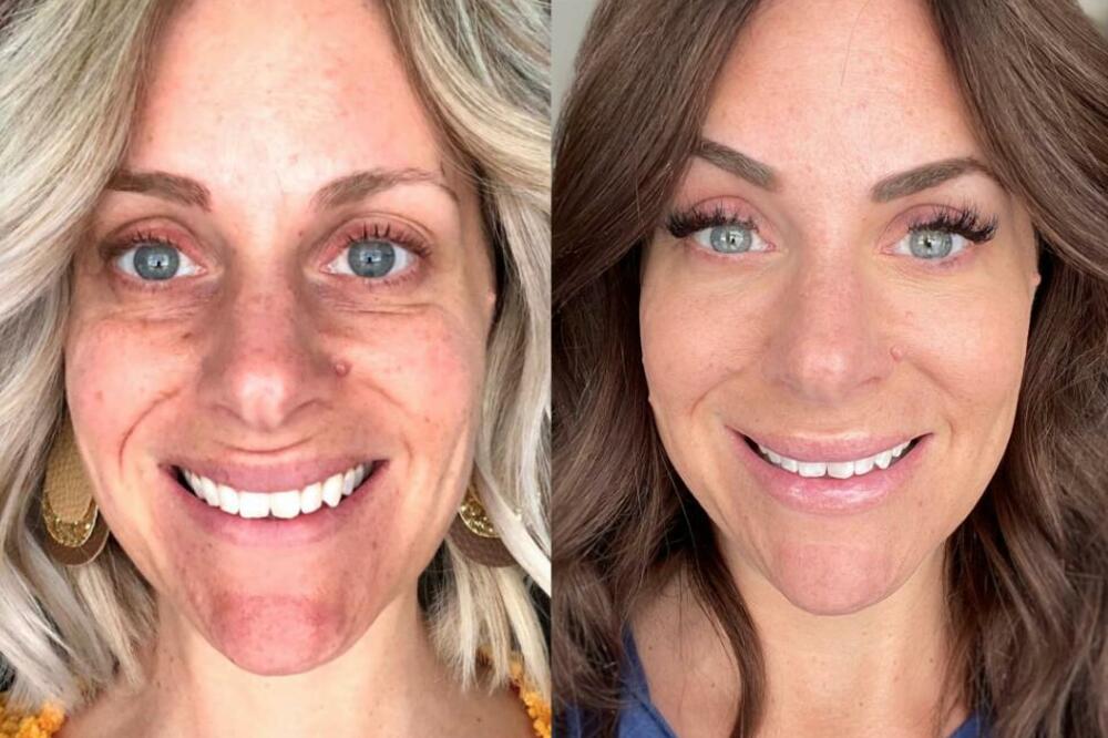 OTKRILA TRIK MLADALAČKOG IZGLEDA: Influenserka priznala tajnu zbog koje izgleda bolje u 40. nego u 30. godinama