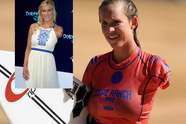 AJKULA JOJ ODGRIZLA CELU RUKU, ONA OPET SURFUJE I PORUČUJE: "Opasnije je voziti kola!" (VIDEO)