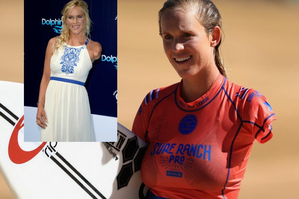 AJKULA JOJ ODGRIZLA CELU RUKU, ONA OPET SURFUJE I PORUČUJE: "Opasnije je voziti kola!" (VIDEO)