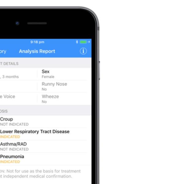 NOVA APLIKACIJA NA TELEFONU OTKRIVA DA LI IMATE KORONU! Ceo svet je želi isprobati (FOTO)