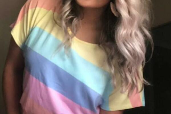 GLEDAMO I NE VERUJEMO: Novopečena MAMA zbog jedne greške OBOJILA bebi kožu!