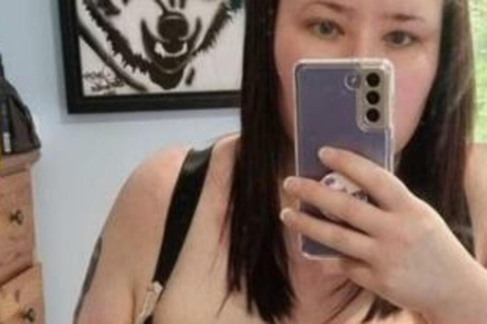 NJENE GRUDI SU TEŠKE PREKO 15 KILOGRAMA: Trpi najveće bolove, a kad ih pokaže usledi ŠOK (FOTO)