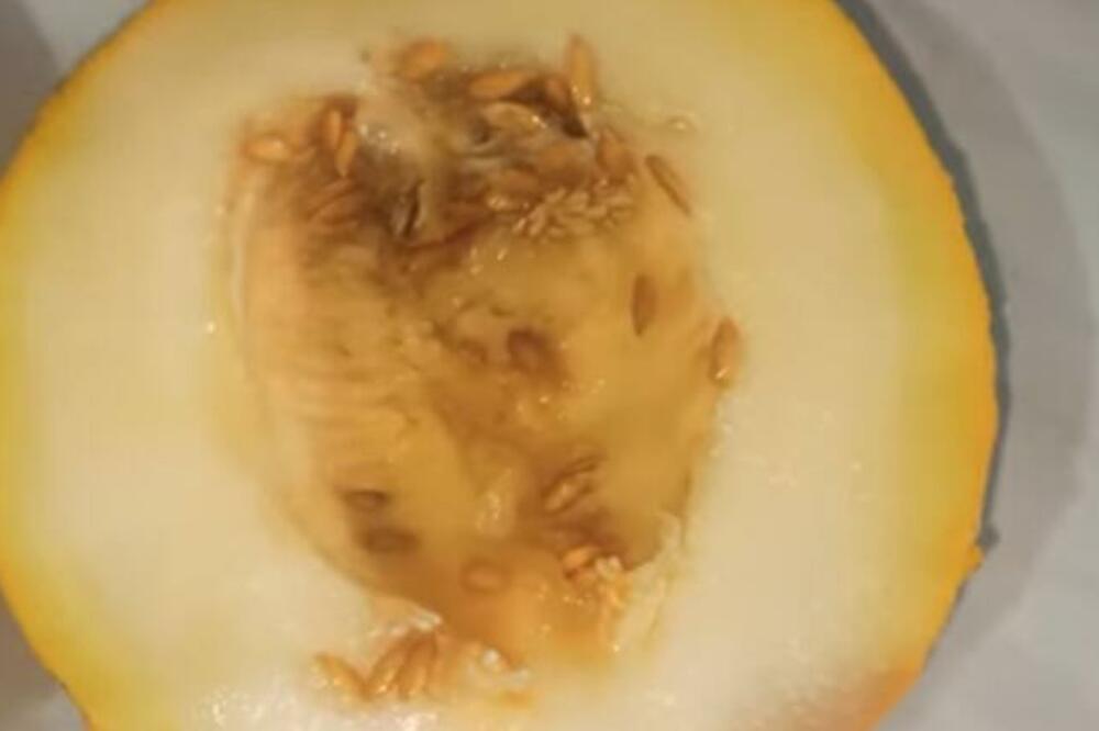 OVO VOĆE IMA NAJVIŠE ŠEĆERA I ZBOG NJEGA NIKAD NEĆETE SMRŠATI: Doktor tvrdi da ga SVEDETE NA MINIMUM