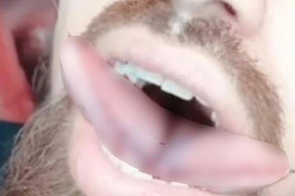 BIZARNO, UZNEMIRUJUĆE! Operacija jezika koja je zabranjena u nekim zemljama! (FOTO)