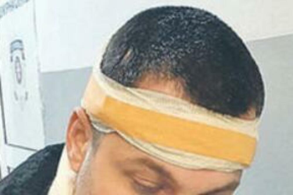 NAPADNUT NAŠ POZNATI PEVAČ: Otvorili mu glavu!