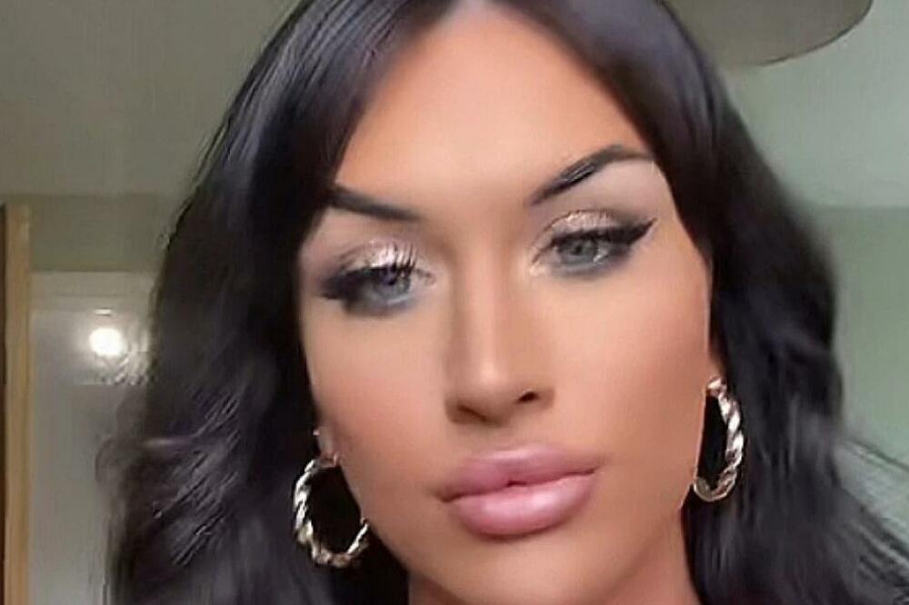 SVI ZA NJOM UZDIŠU, DOK NE USTANE NA NOGE: Svakom od njih uradi OVO na samom početku (FOTO, VIDEO)