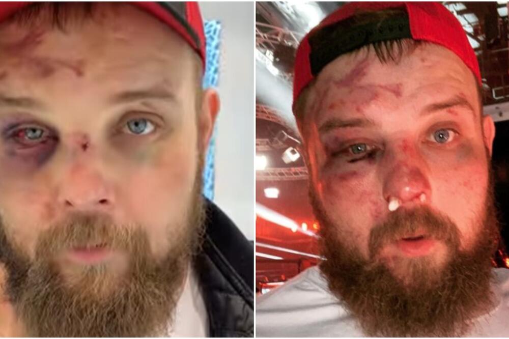 "KRALJ ŠAMARANJA" UNAKAŽEN: "Kupiću sve, samo me više ne udarajte!" (FOTO/VIDEO)