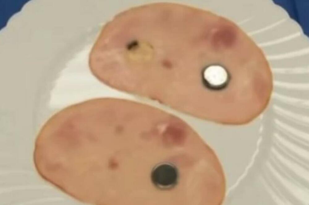 EVO ŠTA SE DESI AKO VAM DETE PROGUTA BAKTERIJU: Posle ovog SNIMKA, sve ćete sklanjati sa stola (VIDEO)