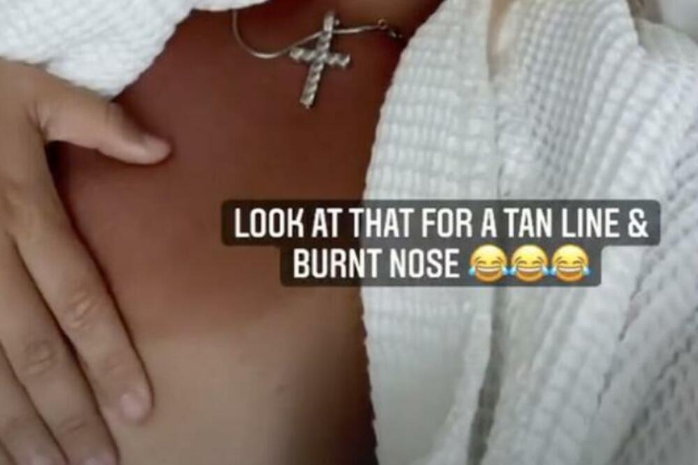 IZAŠAO BEZOBRAZNI SNIMAK POZNATE DAME: Omaklo joj se, i to POŠTENO (FOTO)