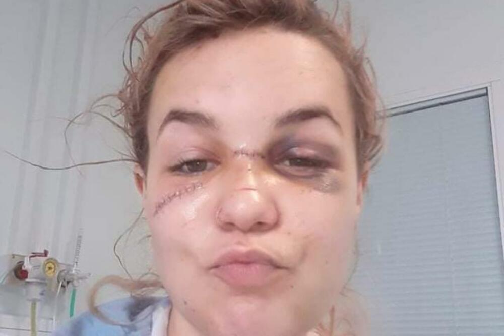 DEČKO JE UBO NOŽEM 11 PUTA, UMALO JE UMRLA: Preživela BRUTALAN napad partnera, pa podelila JEZIVU ispovest! (FOTO)