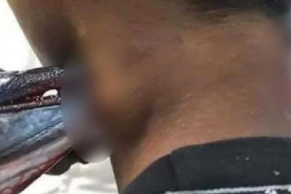 RIBA NASKOČILA NA NJEGA DOK JE PECAO: Čim je stigao u bolnicu, doživeo je još VEĆI ŠOK (UZNEMIRUJUĆE)