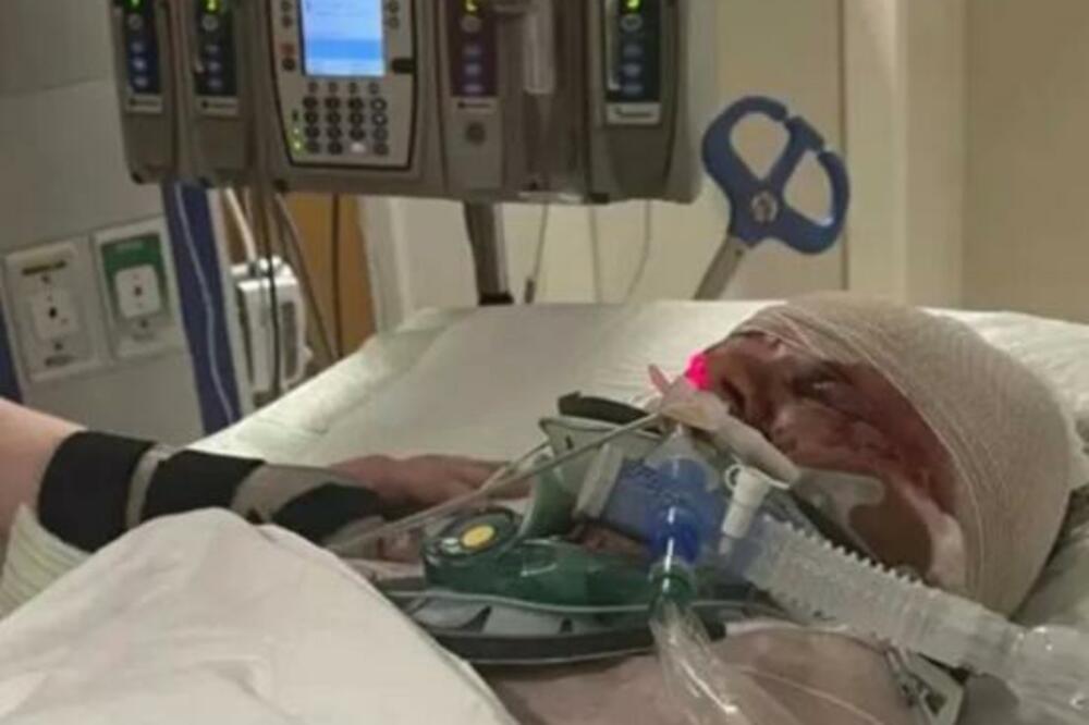 PITBUL ŽENI POJEO RUKE, BRUTALNO SU JE RASTRGLA 3 PITBULA: Jeziv prizor razara dušu (FOTO)