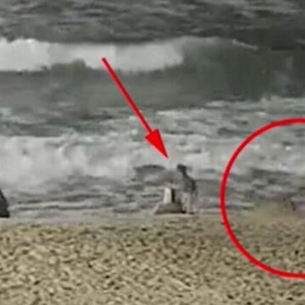 UŽAS U KALIFORNIJI, KRVOLOČNA ZVER NAPALA DETE: Preživljavalo je HOROR 15 sekudni, grizla ga je za LICE (FOTO)