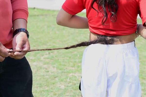 ZOVU GA "DEČAK SA REPOM": Tinejdžer je svoju TAJNU krio čitavih 16 godina, ovo je "Božija volja"!