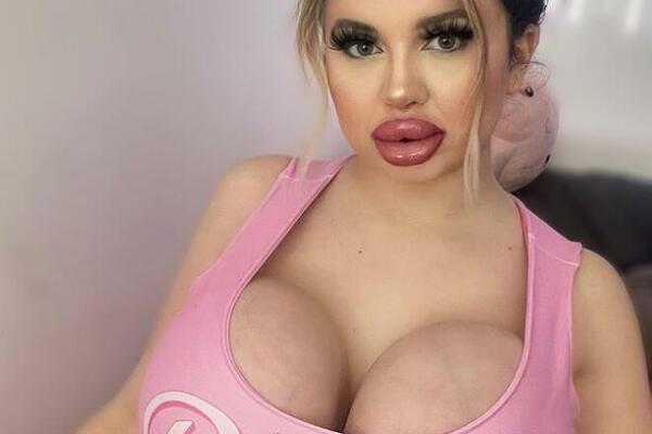 ČAK JE 3 PUTA POVEĆALA GRUDI, A KADA JE URADILA OVO, ODMAH SU JE SE ODREKLI: Nije za one sa slabim srcem (FOTO)