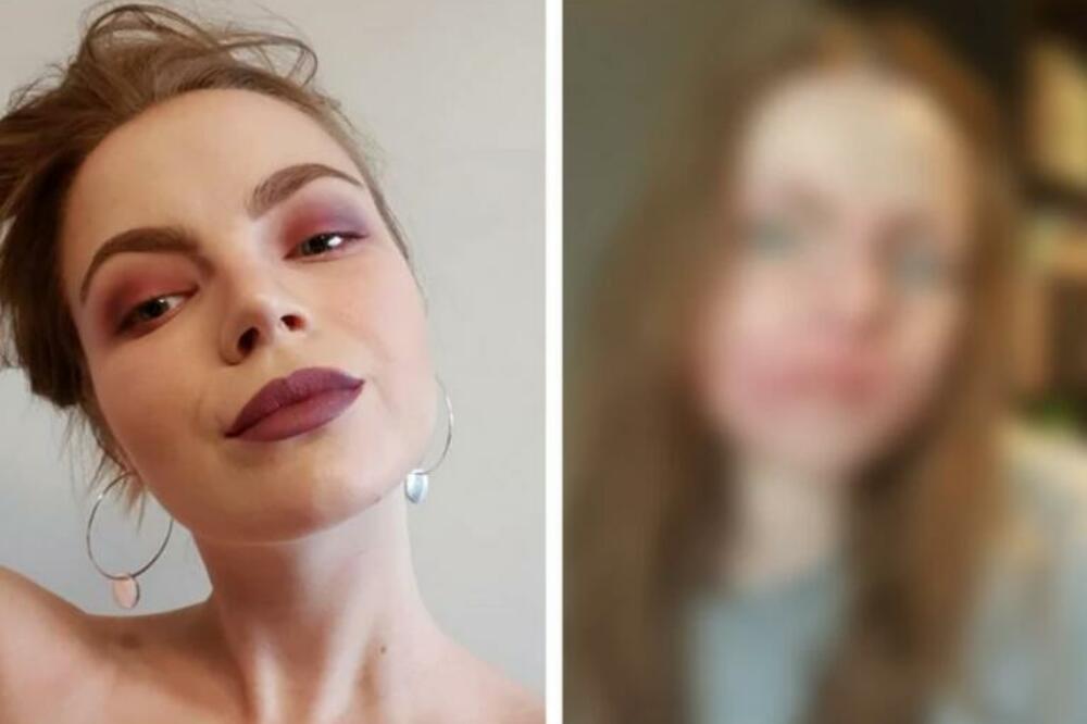 OTIŠLA JE KOD DEČKA U STAN, PA ZAVRŠILA UNAKAŽENOG LICA: Zbog onog se desilo, TRAŽIĆETE MARAMICE (FOTO)